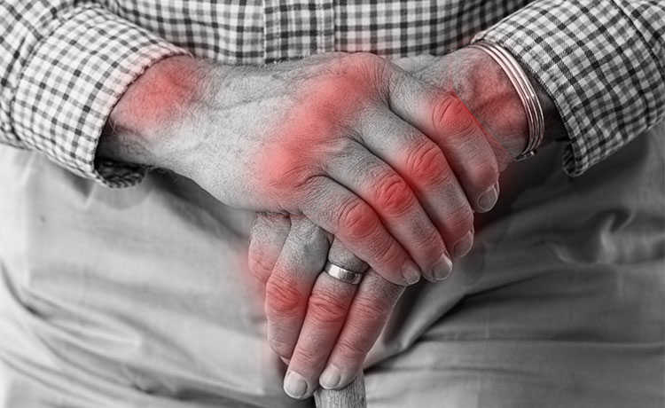 Què és l'artritis: símptomes i tractaments