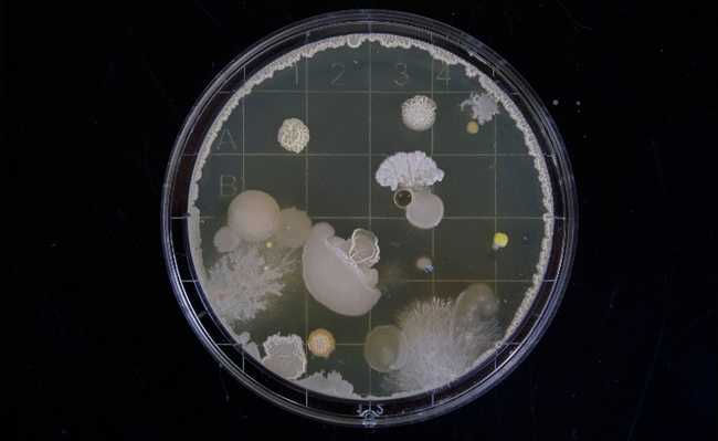 细菌：了解它们是什么并知道如何预防